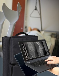 Leonardo DR nano – Eine der weltweit leichtesten tragbaren Röntgenlösungen